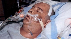 Brain-damaged B.C. Man Alleges RCMP Officer Who Assaulted Him Was On Steroids