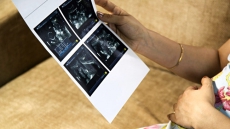 To Curb Sex Determination, Punjab To Engage Detectives