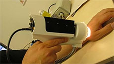 Camera that detects skin cancer in two seconds!