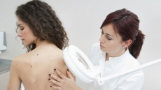 Blocking immune cells may treat deadly skin cancer