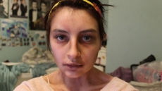 Starvation genes run in families