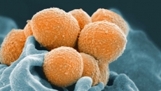 Four children with strep A have died in B.C. in the past month, disease centre says