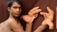 12-Year-old Boy Branded As 'Devil' For Having 'Big Hands'
