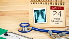 Federal Government Pledges To Eliminate Tuberculosis In The North By 2030