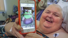 Doctor Removes 130-pound Tumour From Mississippi Man