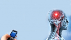Phone use may lead to brain cancer