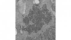 COVID-19 measures could disrupt rare polio-like disease