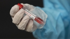 Canada's first case of new COVID variant is detected in B.C.