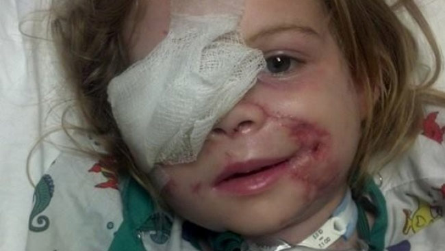 KFC employee allegedly asks three-year-old with pit bull scars to leave restaurant