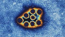 Ancient virus revival poses threat to humans