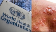 Newly reported monkeypox cases dip worldwide: WHO