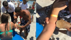 US Woman Rushed To Hospital With Shark Stuck To Arm