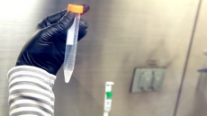 Sperm Bank and Fertility Centre Sued for Allegedly Describing Mentally Ill Sperm Donor as Genius