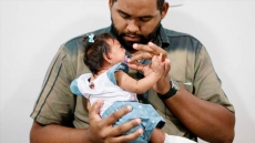 Lab Study Supports Linking Zika Virus To Brain Birth Defect