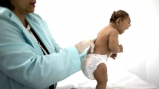 Evidence Of Zika's Risk To Pregnant Women Continues To Grow