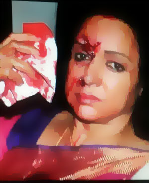 Hema Malini Meets With An Accident