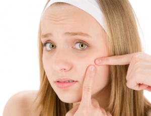 5 Simple Tips To Keep Acne Away